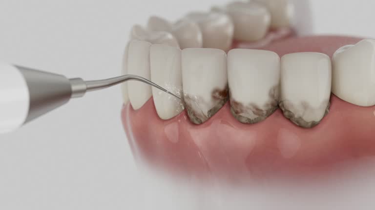 Reliable Dental Crowns And Bridges contractor in Catahoula Parish County, LA by Dentist Open Now